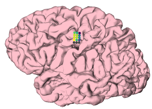 grid3d morphology